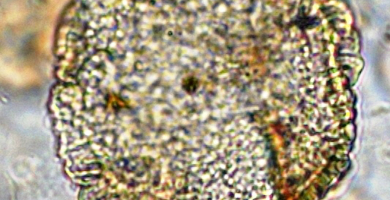 Palynology. Ancient records made in dust